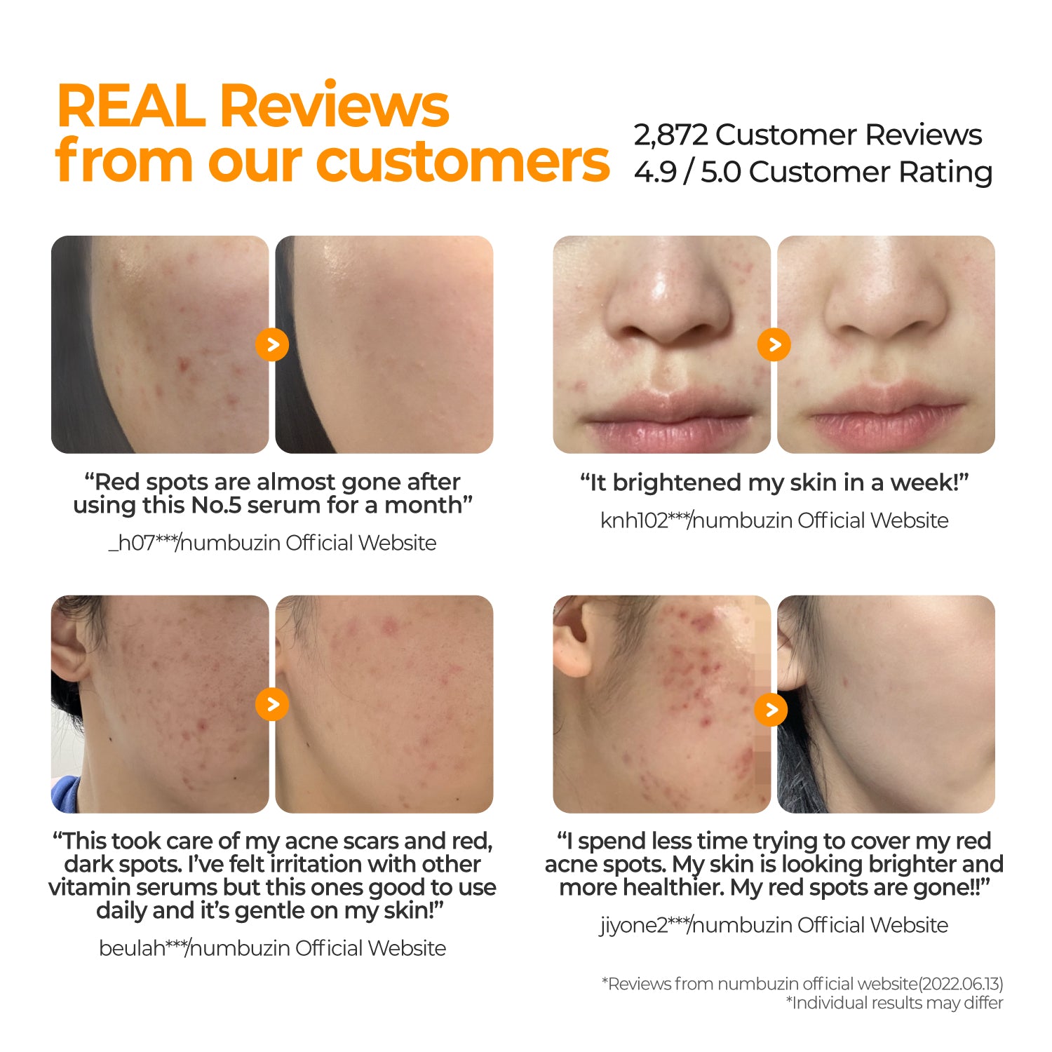 No.5 Goodbye Blemish Serum