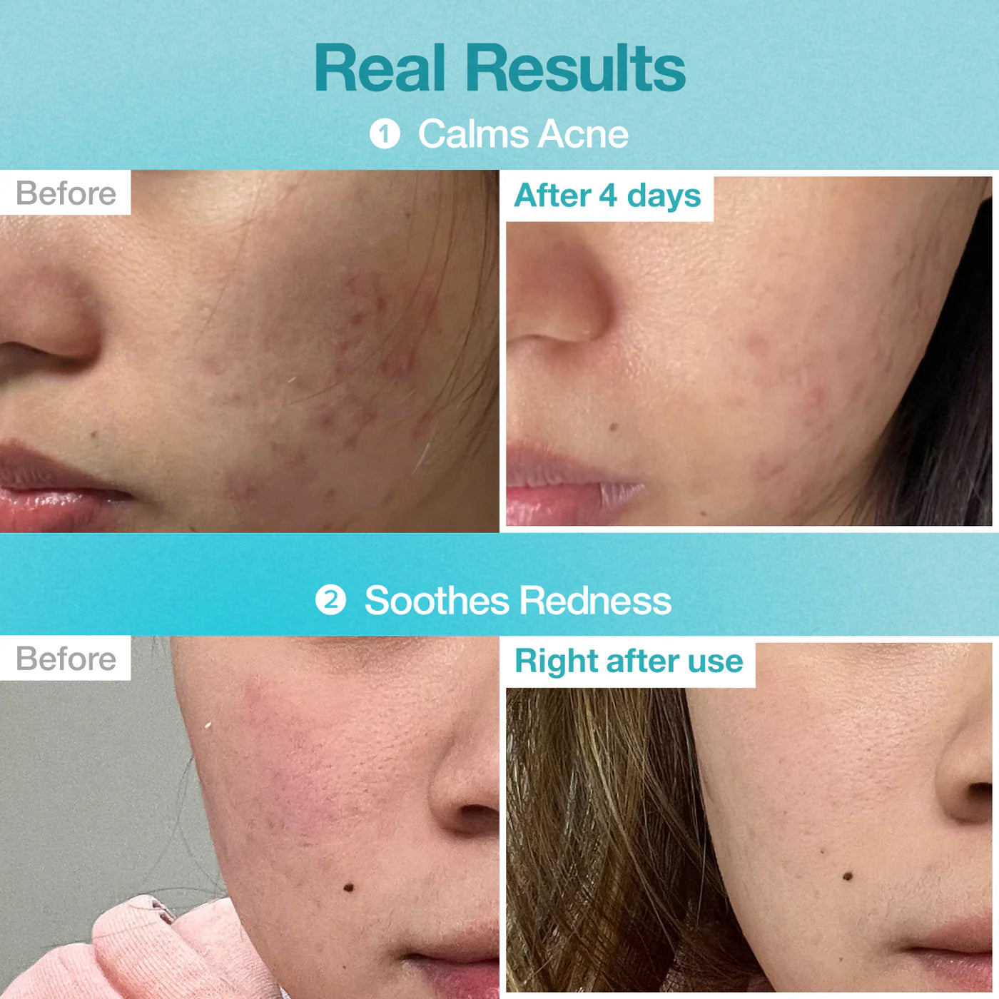 All-in-One Masks Pack (No.1-5)