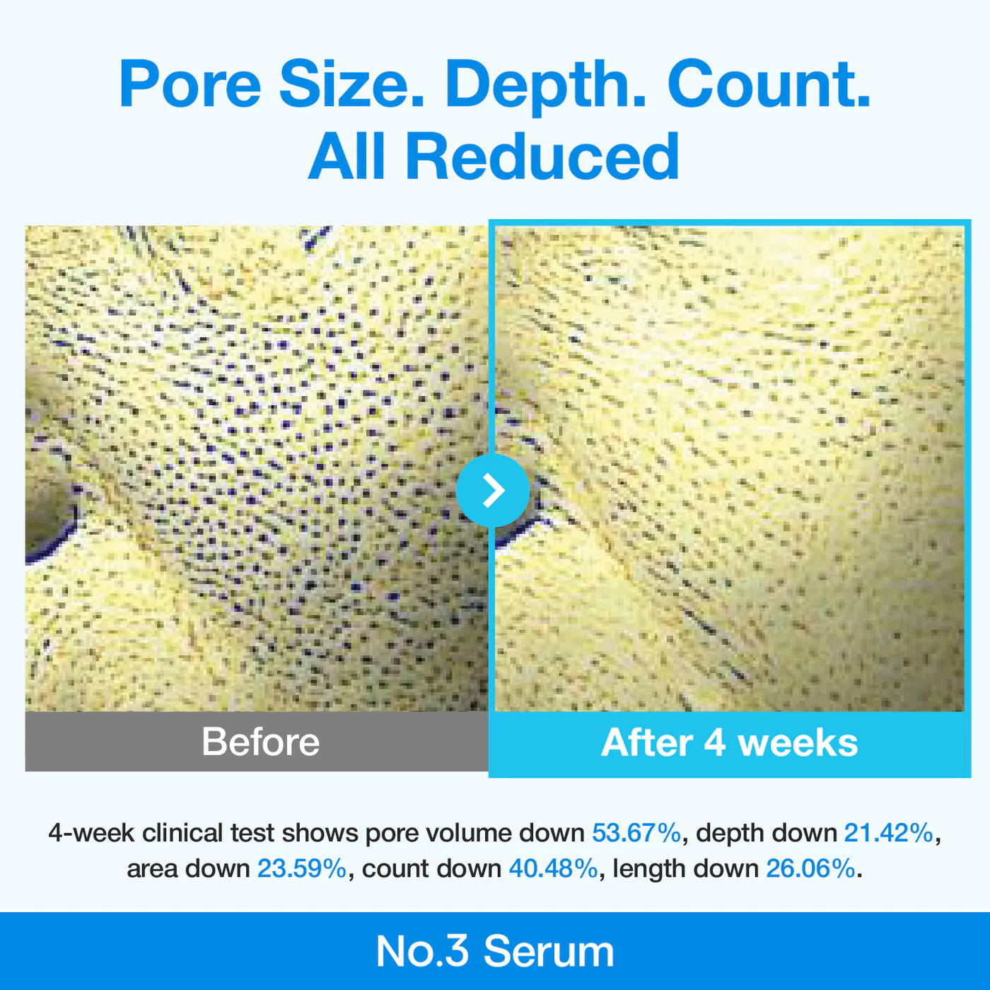 Pore Tightening Routine Set