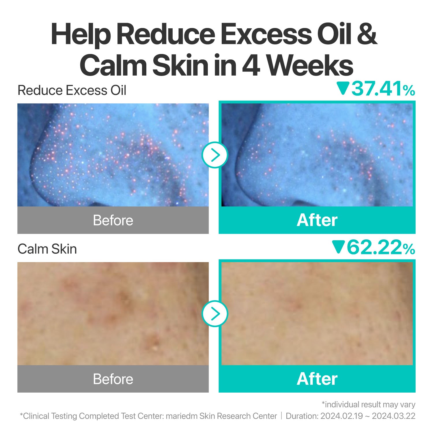No.1 Hydration Calming Duo