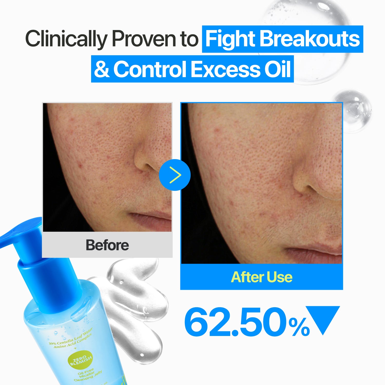 No.0 Zero Blemish Oil-Free Micellar Cleansing Jelly