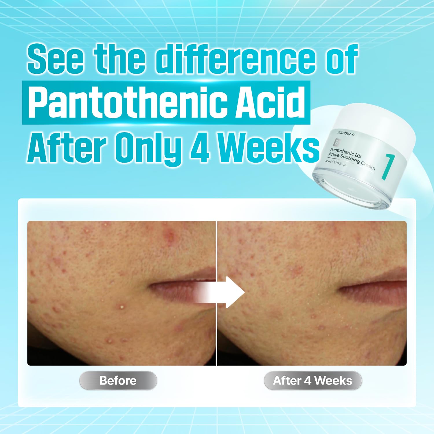No.1 Pantothenic B5 Active Soothing Cream