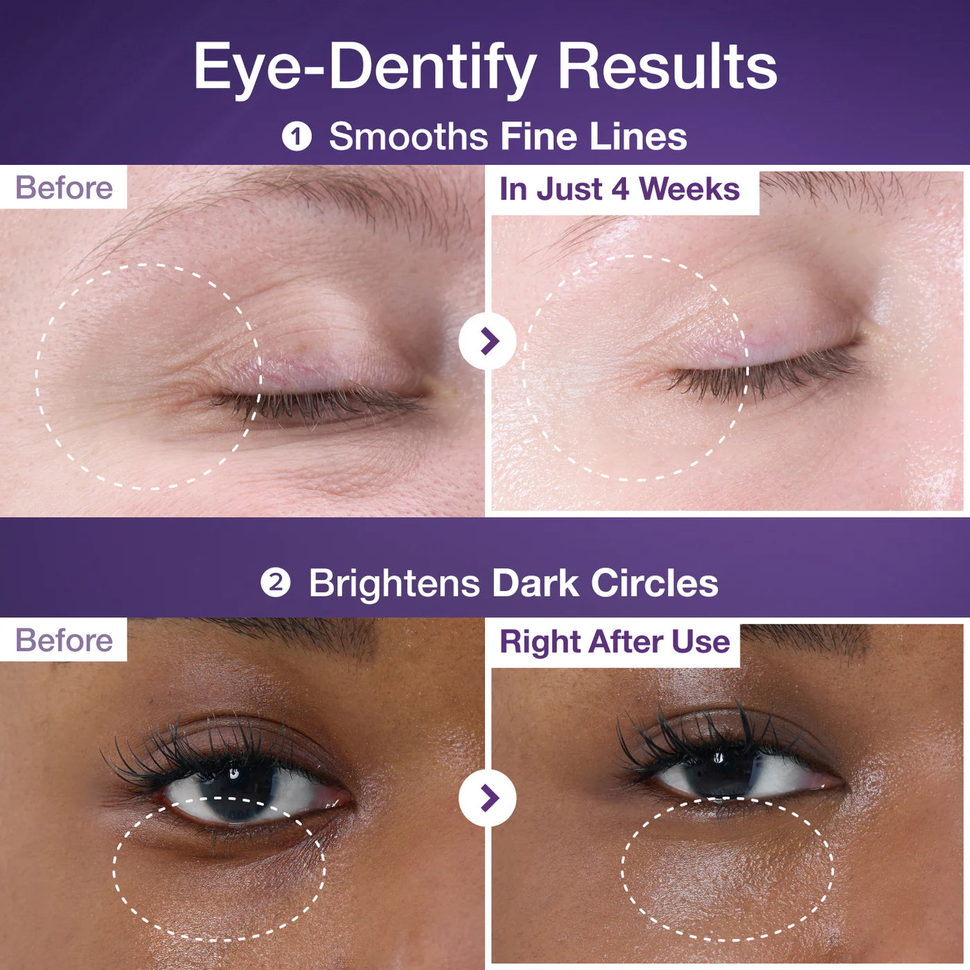 Special Eye Treatment Set