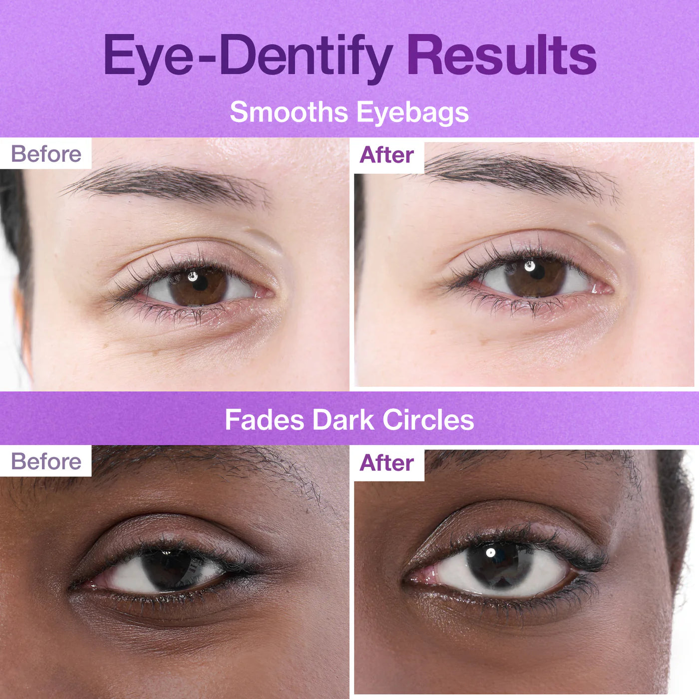 Special Eye Treatment Set