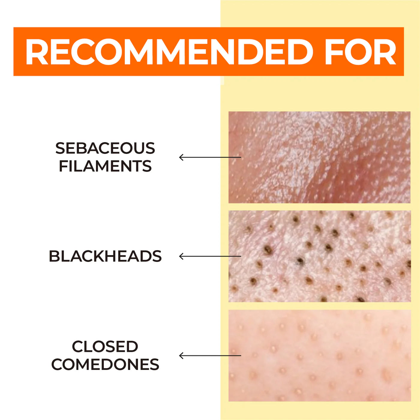 Pore Tightening Routine Set