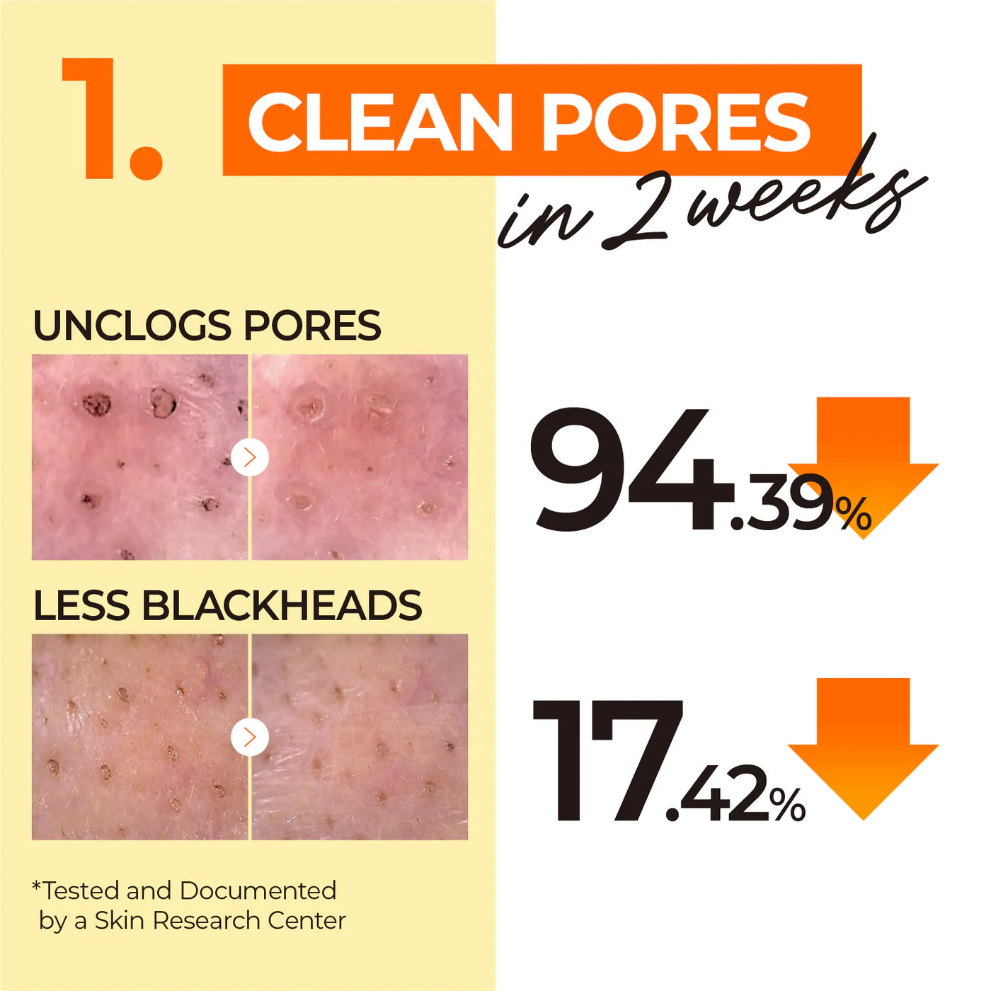 Pore Tightening Routine Set