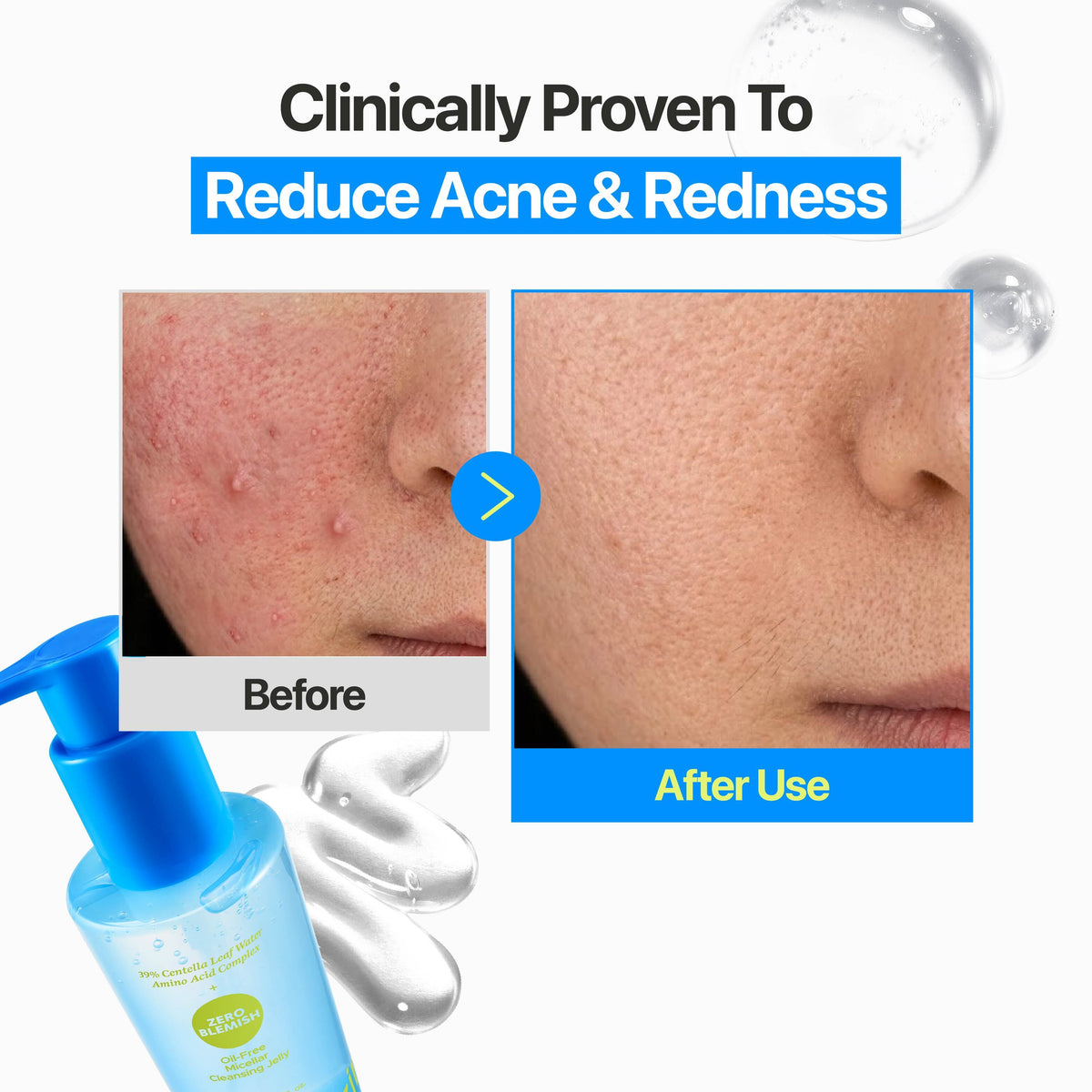 Oil-Free Cleansing Jelly