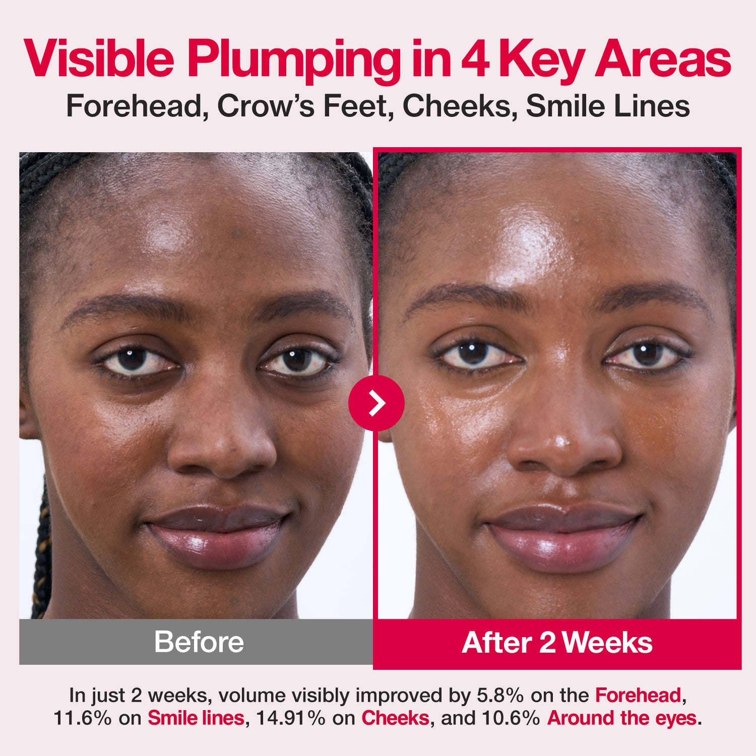 No.2 & 2X Rose PDRN Collagen Plumping Serum Mini Kit (10EA)