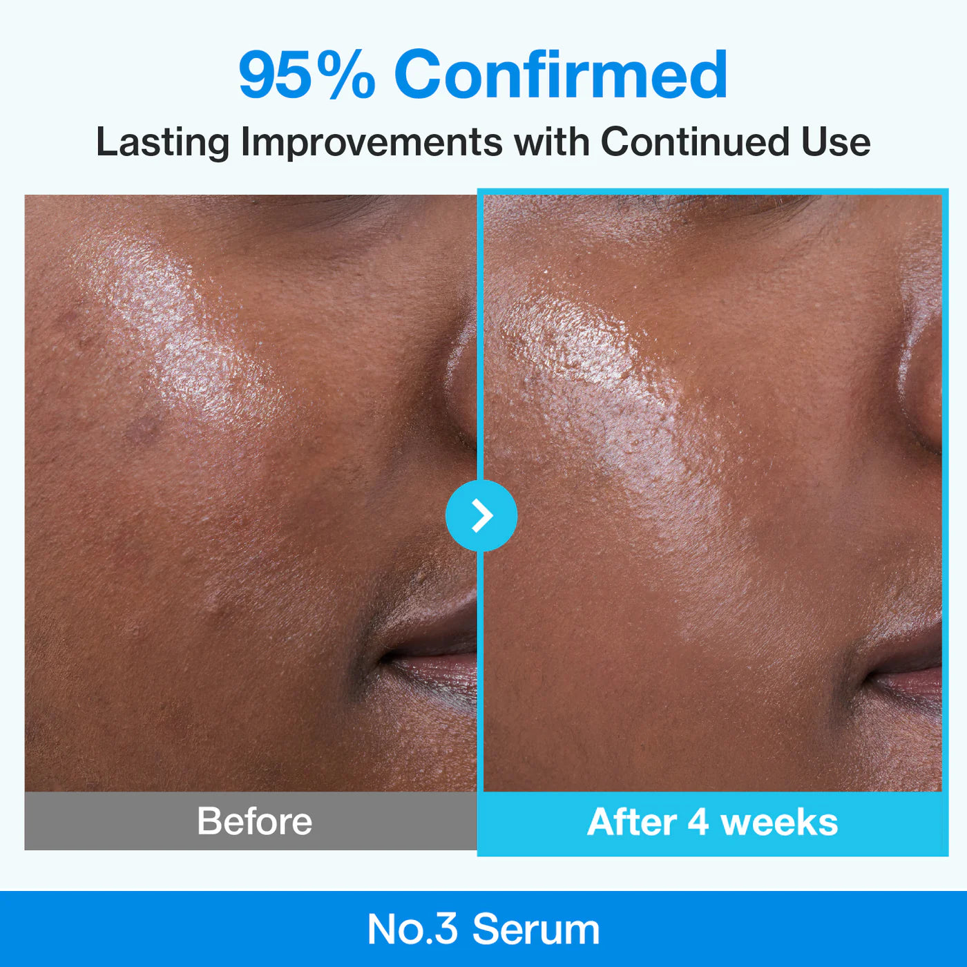 Pore Tightening Routine Set