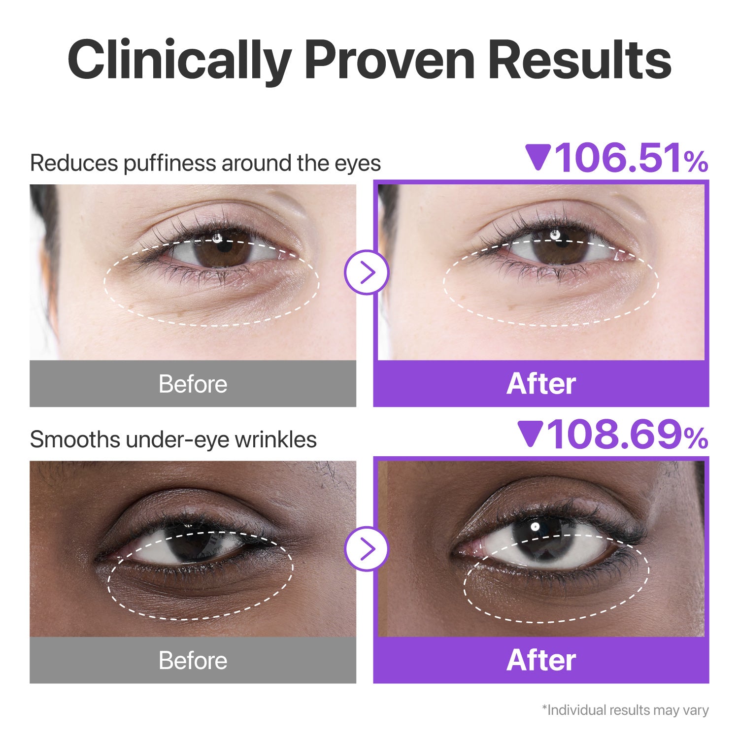 No.9 NAD+ Collagen Under Eye Patches (5 Pairs)