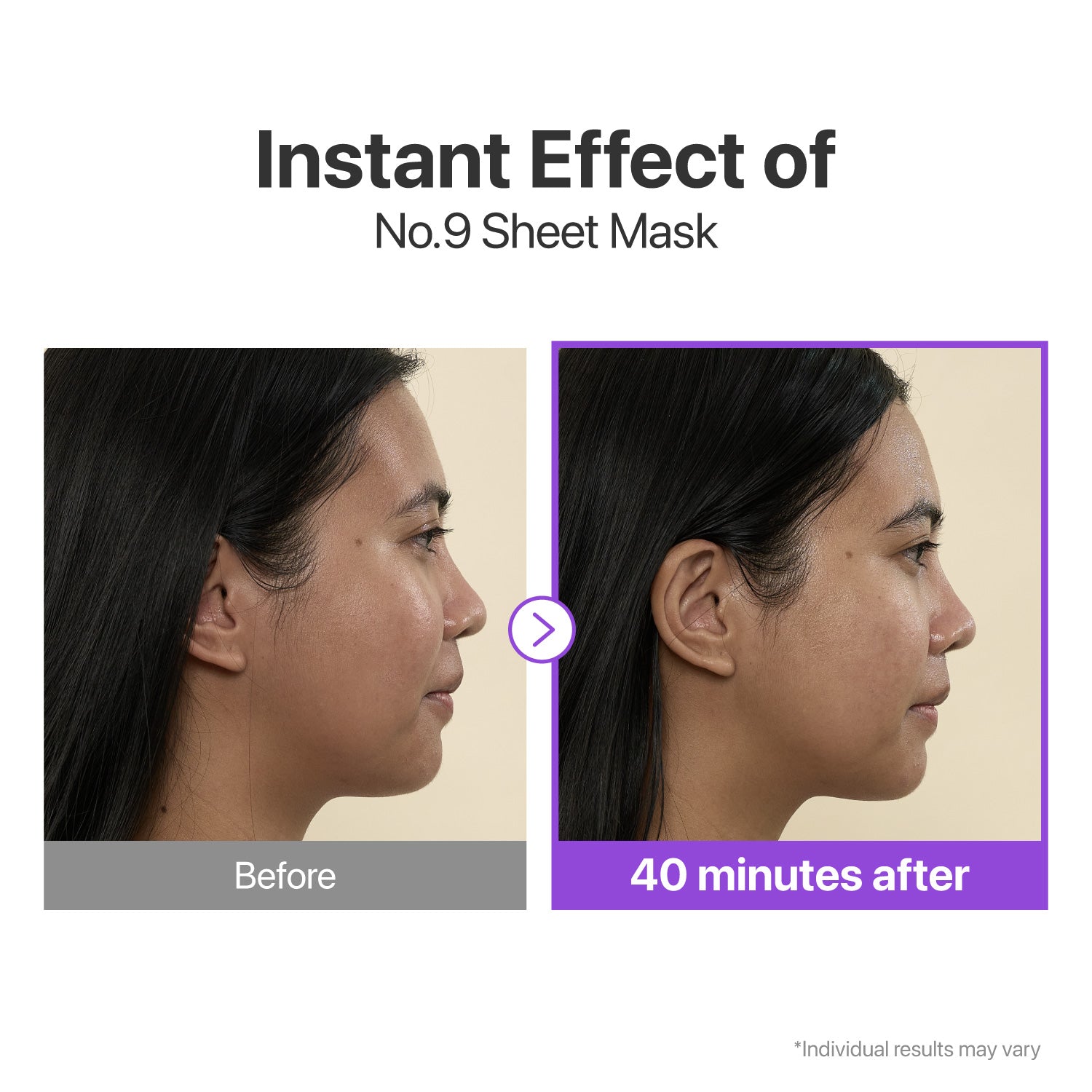 No.9 NAD+ BIO Face Mask Bundle (16 Sheets + 4 Lifting Bands)