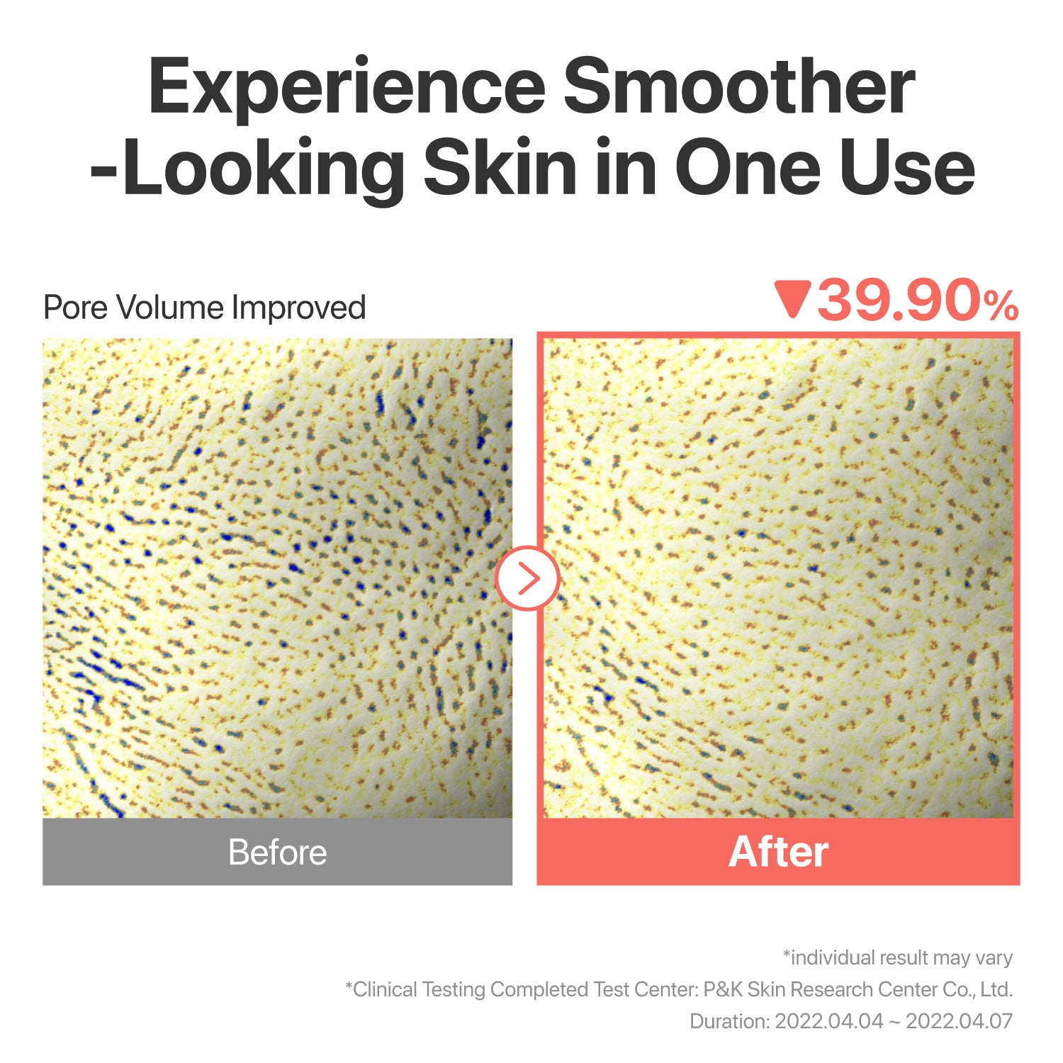 No.3 Tingle-Pore Softening Sheet Mask (5 Sheets)