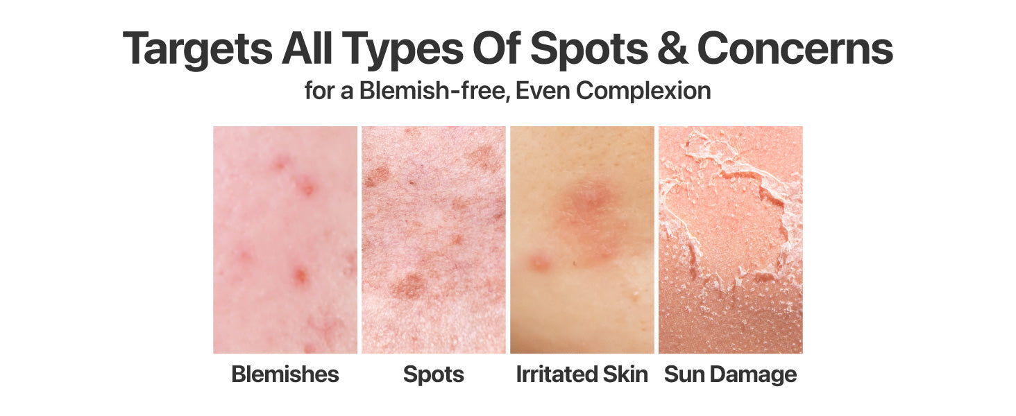 No.5+ Glutathione Vitamin Dark Spot Cream No.5+ Glutathione Vitamin Dark Spot Cream