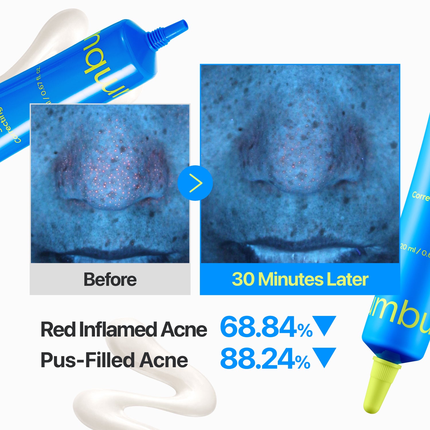 No.0 Zero Blemish 3X Spot Correcting Cream