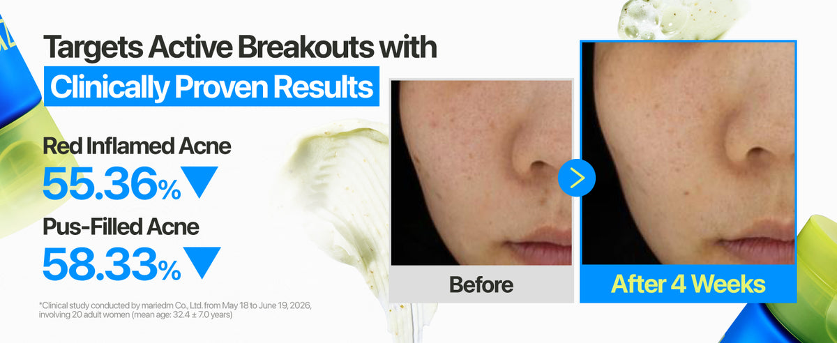Promotional graphic for an acne treatment claim, with text stating 'Targets Active Breakouts with Clinically Proven Results' and before/after skin close-ups of a nose area showing reduced red and pus-filled acne after 4 weeks.