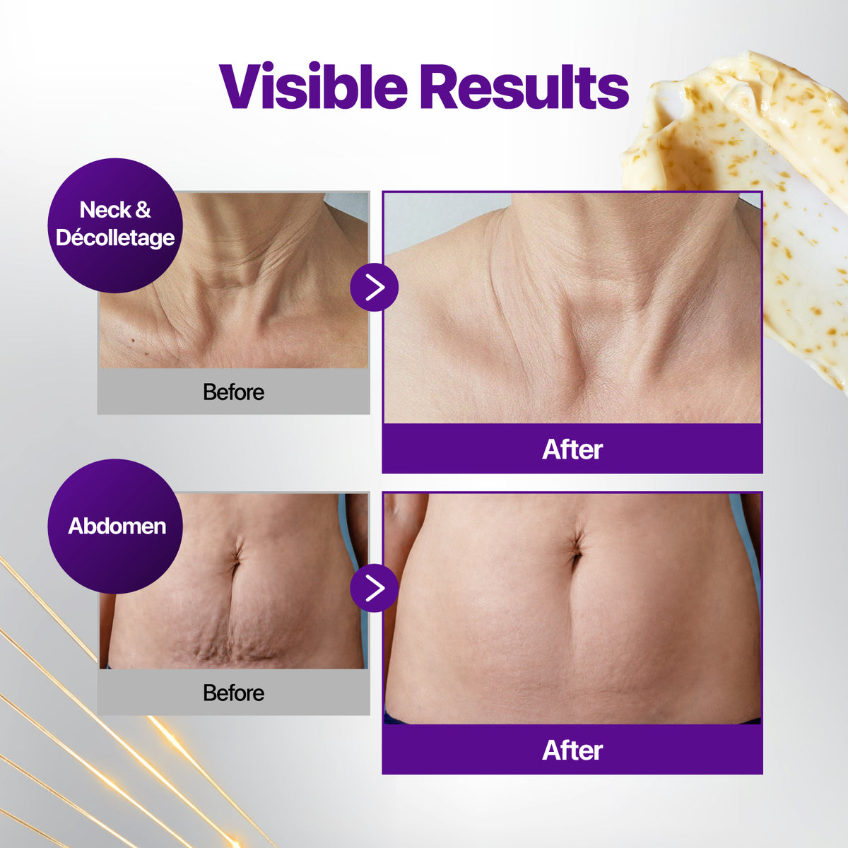 [#1 NAD] Gold NAD+ Firming Cream
