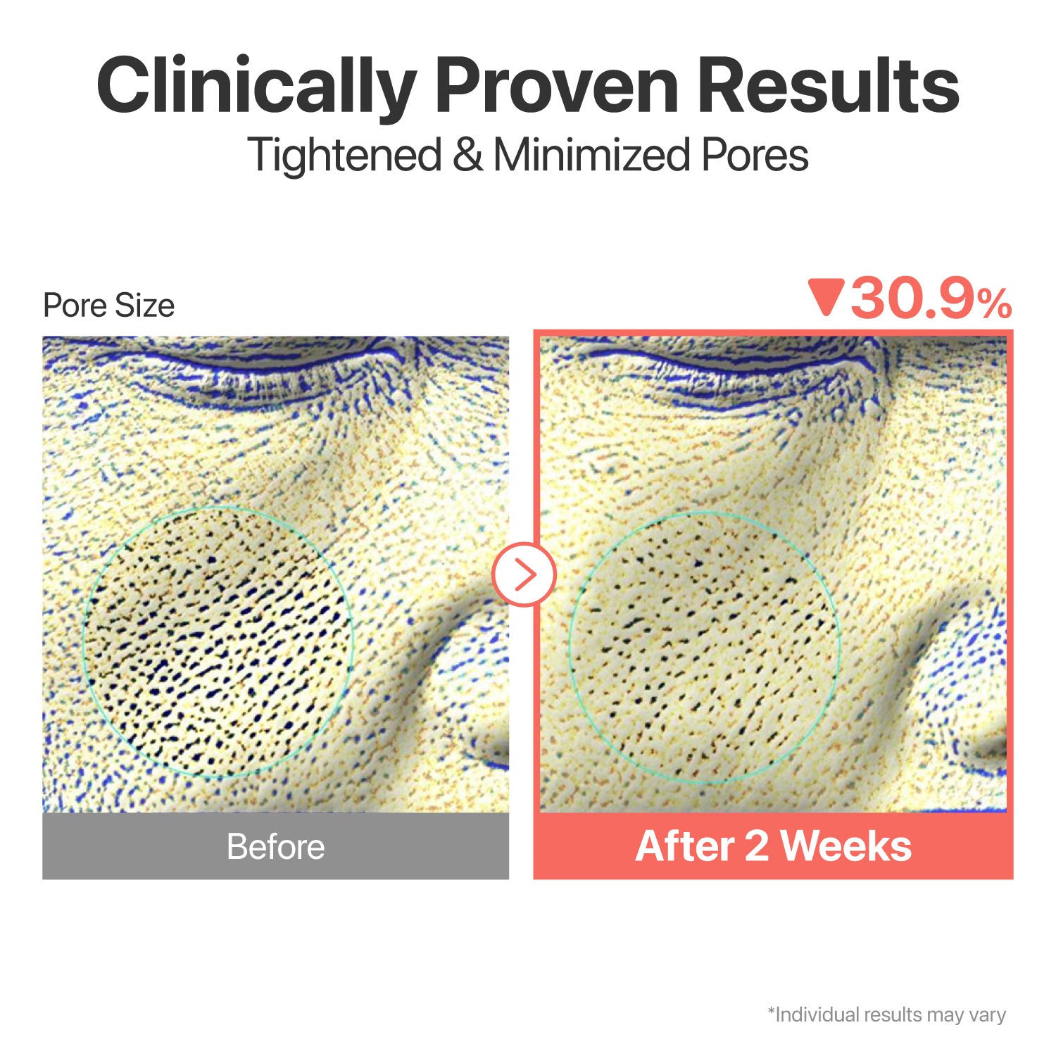 No.3 Skin Softening Serum